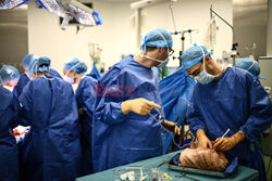 Transplantologia we Francji - AFP