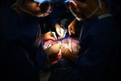 Transplantologia we Francji - AFP