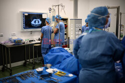 Transplantologia we Francji - AFP