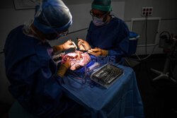 Transplantologia we Francji - AFP