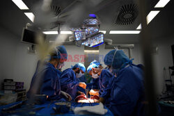 Transplantologia we Francji - AFP