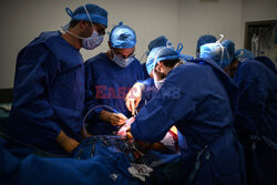 Transplantologia we Francji - AFP